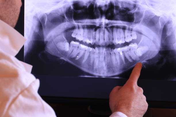Best Urgent Care for Lost Fillings or Crowns in Due West, SC