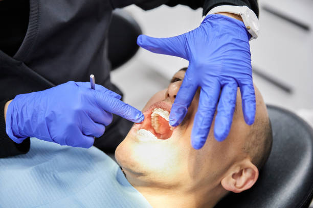 Best Emergency Root Canal Treatment in Due West, SC
